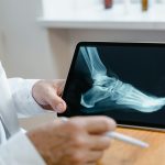 Poor usability of electronic health records in Norway | Tidsskrift for Den norske legeforening | Doctors must interact with digital systems in their daily work. The primary tool is the electronic health record (EHR). The Norwegian Patient Records ...