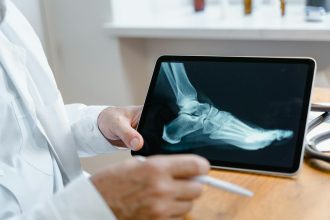 Poor usability of electronic health records in Norway | Tidsskrift for Den norske legeforening | Doctors must interact with digital systems in their daily work. The primary tool is the electronic health record (EHR). The Norwegian Patient Records ...