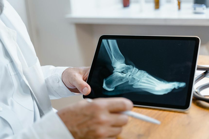 Poor usability of electronic health records in Norway | Tidsskrift for Den norske legeforening | Doctors must interact with digital systems in their daily work. The primary tool is the electronic health record (EHR). The Norwegian Patient Records ...