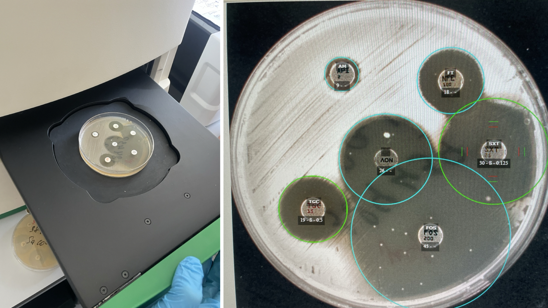 Antibiotic_Sensitivity_Testing_Plate_reader-3