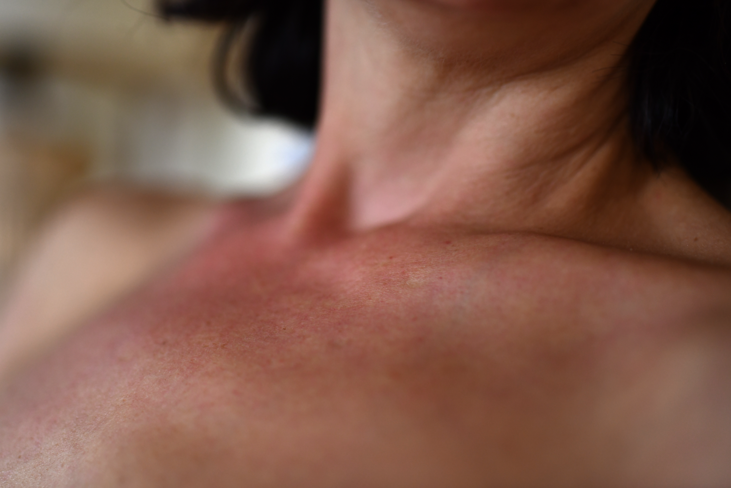 Beyond the Neck: Why Structural Rigidity Is Your Greatest Asset