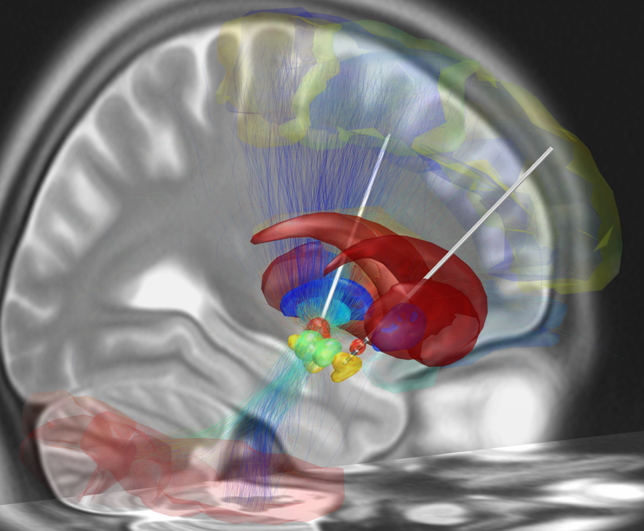 Beyond Stimulation: Why the Real Bio-Hacking Edge is Sensory Deprivation