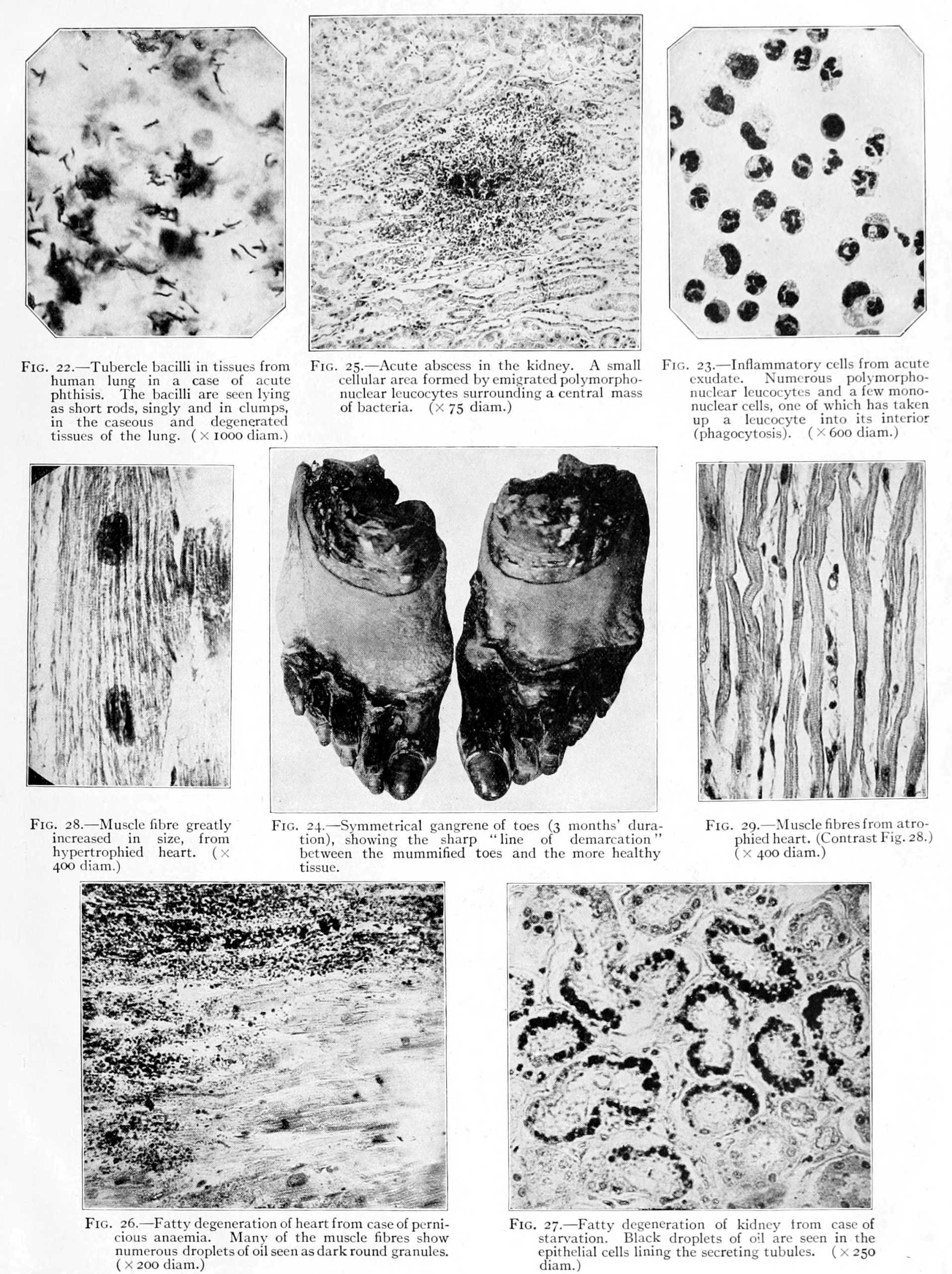 The Pathology of Precision: Why Over-Optimization Kills High-Performance Systems