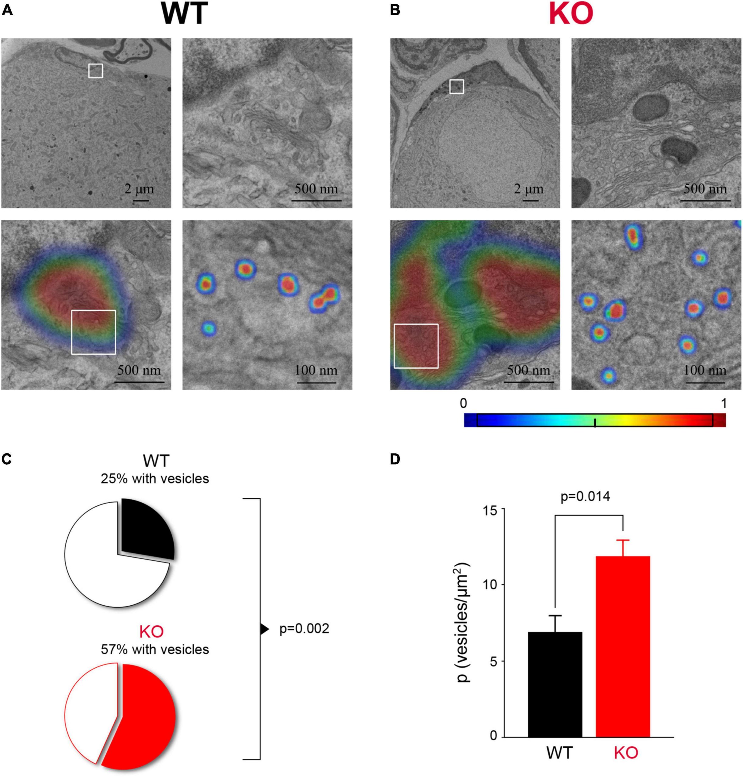 Gradient-weighted Class Activation Mapping (Grad-CAM) extends CAM to architectures without global pooling. Increased_vesicle_number_in_Fmr1_KO_SGC_cytoplasm-1