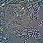 Detailed microscopic imagery of microorganisms at high magnification.