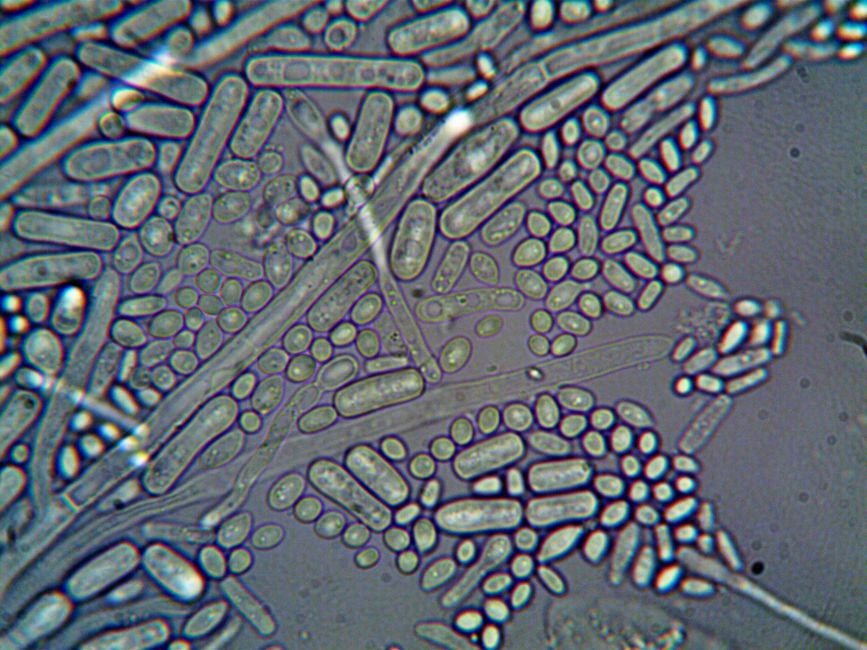 Detailed microscopic imagery of microorganisms at high magnification.