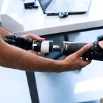 Exoskeletons: Removing Human Biological Limits in Operations Person helping another attach a prosthetic arm, showcasing technology and support.