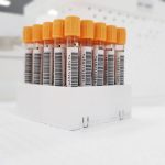 Molecular Diagnostic Platforms: Strategic Operational Insight Blood sample test tubes with barcodes organized in a laboratory setting.