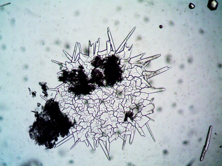 Detailed view of fungal spores and hyphae, showcasing cellular structure in microbiology.
